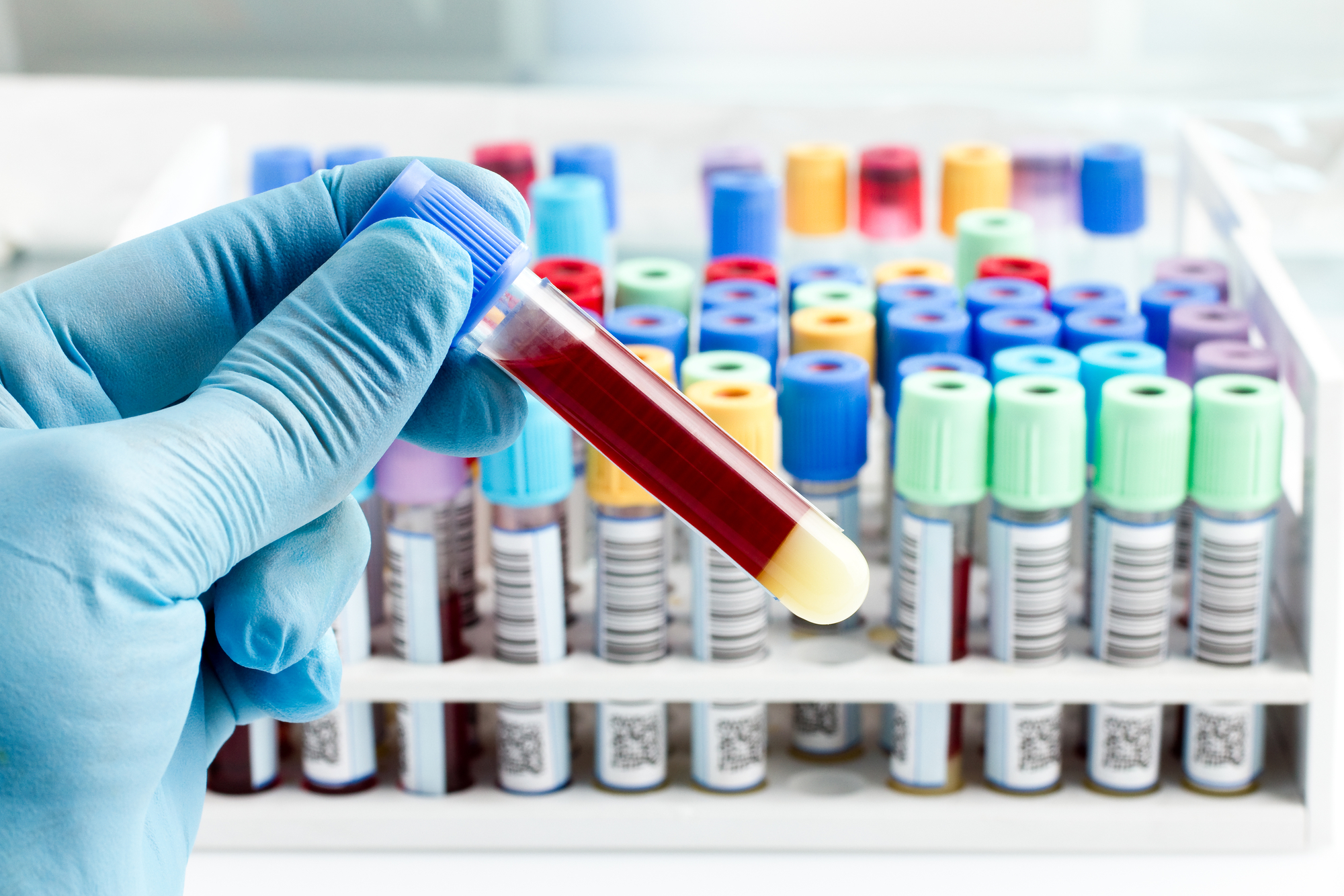 Blood test nutrigenomics