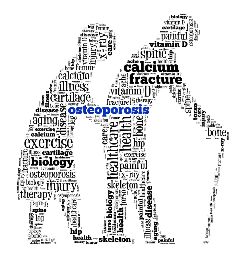image of osteoporosis word collage