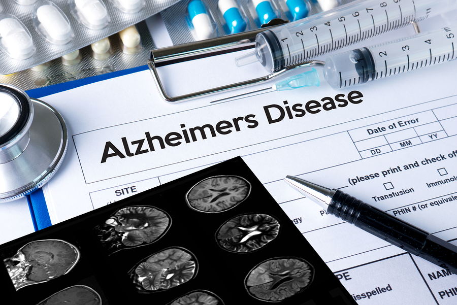 New Data About Alzheimer’s