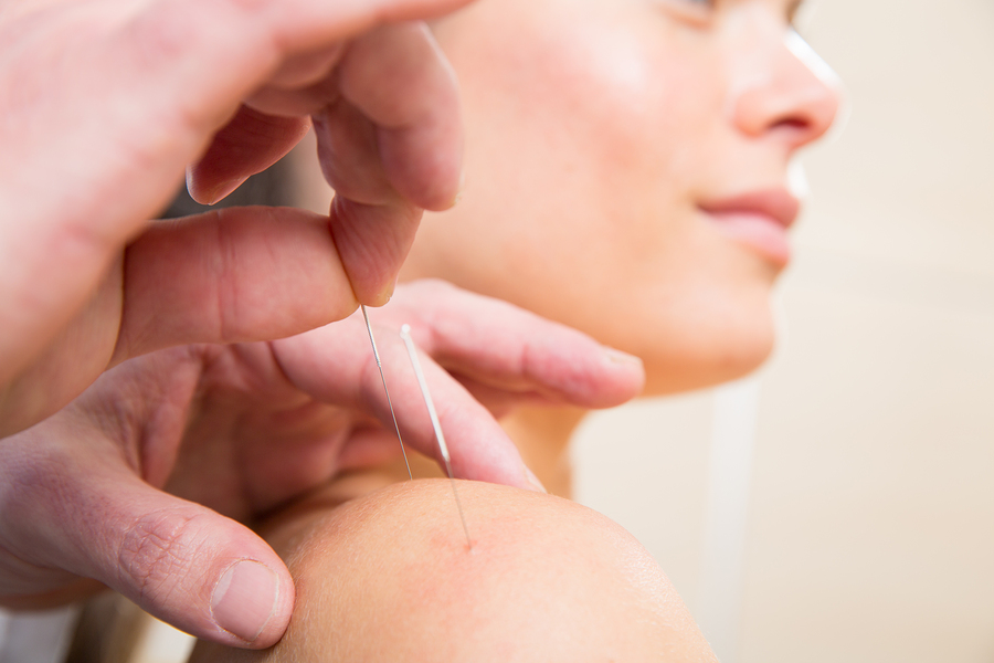 acupuncture for cancer care