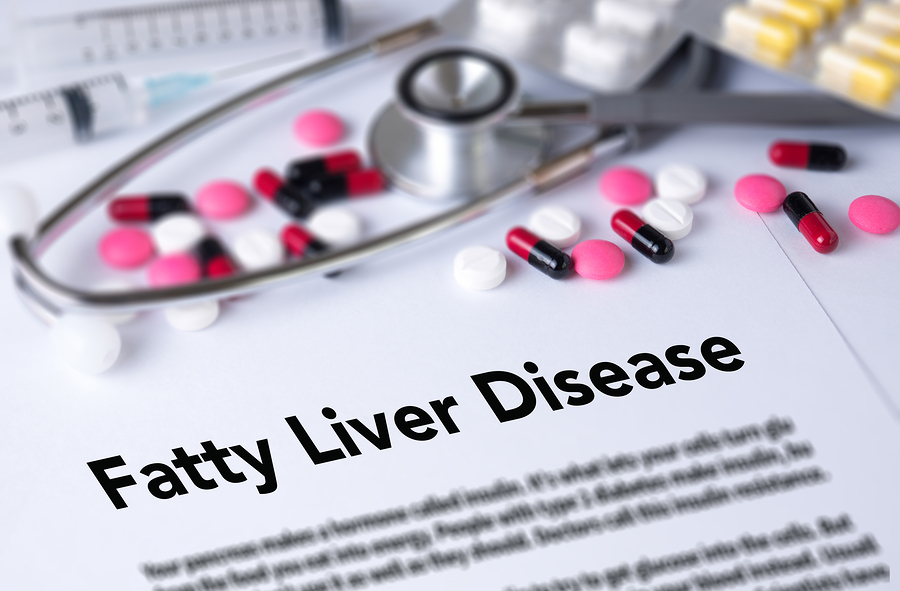 Fatty Liver Disease 
